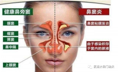 <b>武当派《太和门》秘传《鼻炎养生导引术及秘方》</b>